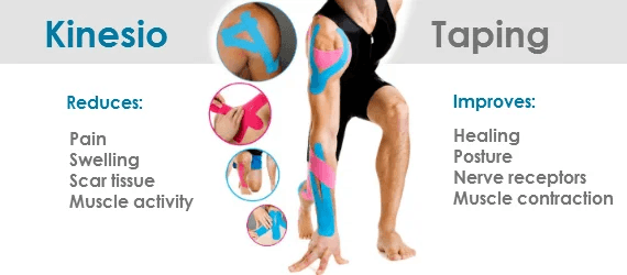 Kinesiotaping works on multiple areas of the body
